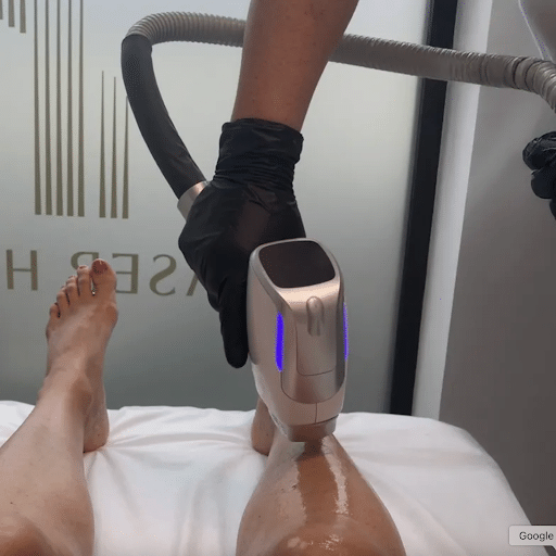 Read more about the article Lasersko odstranjevanje dlak poleti: Zakaj v Laser House ne poznamo »poletnega premora«?