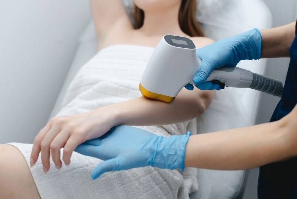 Read more about the article Lasersko (trajno) odstranjevanje dlak: Vse, kar morate vedeti